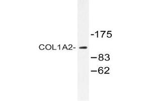 Western blot (WB) analysis of COL1A2 antibody in extracts from 293 cells. (COL1A2 Antikörper  (Chain alpha 2))