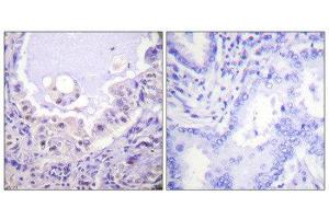 Immunohistochemistry (IHC) image for anti-V-Raf-1 Murine Leukemia Viral Oncogene Homolog 1 (RAF1) (Ser621) antibody (ABIN1847970) (RAF1 Antikörper  (Ser621))