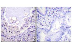 Immunohistochemistry (IHC) image for anti-V-Raf-1 Murine Leukemia Viral Oncogene Homolog 1 (RAF1) (Ser621) antibody (ABIN1847970)