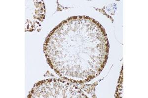 Immunohistochemistry (Paraffin-embedded Sections) (IHC (p)) image for anti-Cold Inducible RNA Binding Protein (CIRBP) (AA 1-172) antibody (ABIN6138628)