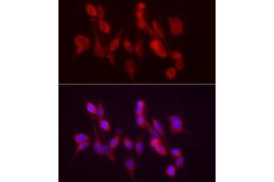 Immunofluorescence analysis of PC-12 cells using /GSNOR Rabbit pAb (ABIN6131172, ABIN6136579, ABIN6136580 and ABIN6217464) at dilution of 1:50 (40x lens). (ADH5 Antikörper  (AA 1-374))