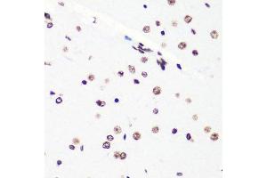 Immunohistochemistry (Paraffin-embedded Sections) (IHC (p)) image for anti-Histone H4 (2meLys20) antibody (ABIN3016048)