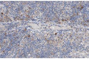 ABIN6266950 at 1/100 staining human lymph node tissue sections by IHC-P. (NCK2 Antikörper  (Internal Region))