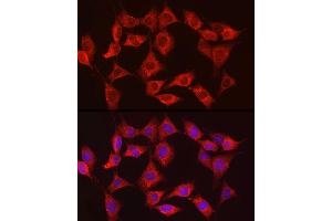 Immunofluorescence analysis of NIH/3T3 cells using HK3 Rabbit pAb (ABIN6131756, ABIN6141801, ABIN6141802 and ABIN6224488) at dilution of 1:150 (40x lens). (HK3 Antikörper  (AA 1-270))
