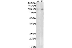 ABIN1590037 (1 µg/mL) staining of MCF7 (A) and Human Breast cancer (B) lysates (35 µg protein in RIPA buffer). (BCAR1 Antikörper  (Internal Region))