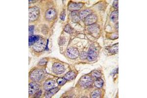 Image no. 2 for anti-Cadherin 13 (CDH13) (C-Term) antibody (ABIN356921) (Cadherin 13 Antikörper  (C-Term))