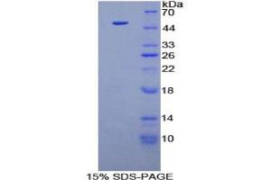 SDS-PAGE analysis of Human FGF6 Protein. (FGF6 Protein)