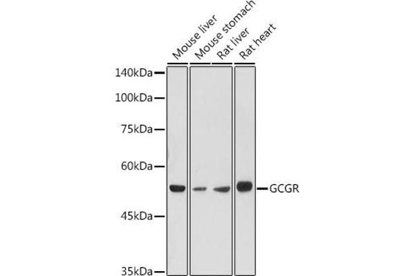 Glucagon Receptor Antikörper  (AA 1-140)