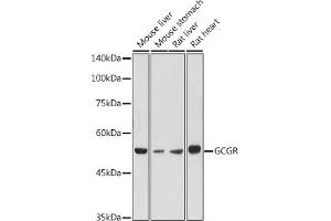 Western blot analysis of extracts of various cell lines, using GCGR antibody (ABIN7267394) at 1:1000 dilution. (Glucagon Receptor Antikörper  (AA 1-140))