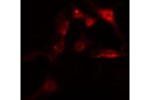 ABIN6275142 staining  HeLa cells by IF/ICC. (IFI16 Antikörper  (C-Term))