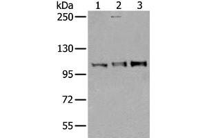 Western blot analysis of Mouse testis tissue Jurkat and A549 cell lysates using USO1 Polyclonal Antibody at dilution of 1:350 (USO1 Antikörper)