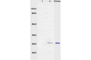 Lane 1: mouse embryo lysates Lane 2: mouse brain lysates probed with Anti RASSF3 Polyclonal Antibody, Unconjugated (ABIN762101) at 1:200 in 4 °C. (RASSF3 Antikörper  (AA 51-150))