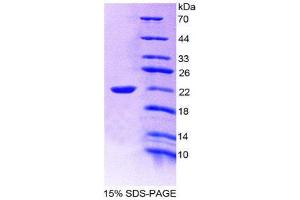 SDS-PAGE (SDS) image for Interleukin 19 (IL19) (AA 25-177) protein (His tag) (ABIN2125470)