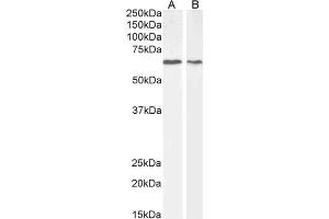 ABIN6391337 (2µg/ml) staining of MCF7 (A) and NIH3T3 (B) cell lysate (35µg protein in RIPA buffer). (AKT1 Antikörper  (Internal Region))