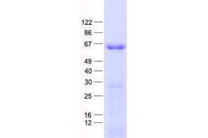 Validation with Western Blot