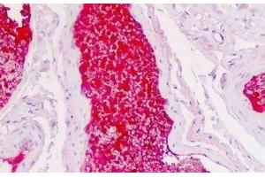 Human Colon, Vessel Plasma: Formalin-Fixed, Paraffin-Embedded (FFPE) (SERPINA1 Antikörper)