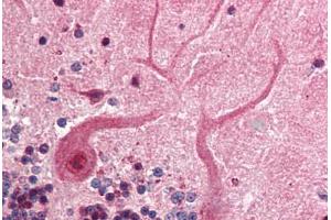 Human Brain, Cerebellum (formalin-fixed, paraffin-embedded) stained with SKP1 antibody ABIN218526 at 1:500 followed by biotinylated goat anti-rabbit IgG secondary antibody ABIN481713, alkaline phosphatase-streptavidin and chromogen. (SKP1 Antikörper  (C-Term))