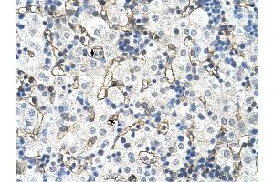 SLC39A5 antibody was used for immunohistochemistry at a concentration of 4-8 ug/ml to stain Hepatocytes (arrows) in Human Liver.