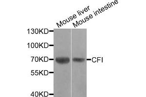 Western blot analysis of extracts of various cell lines, using CFI antibody. (Complement Factor I Antikörper)