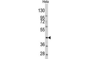 Western Blotting (WB) image for anti-Platelet-Derived Growth Factor Receptor-Like (PDGFRL) antibody (ABIN3003406) (PDGFRL Antikörper)