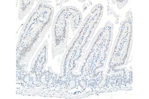 Immunohistochemistry (IHC) image for anti-AT Rich Interactive Domain 1B (SWI1-Like) (ARID1B) (AA 1425-1475) antibody (ABIN7795694) (Rekombinanter ARID1B Antikörper  (AA 1425-1475))