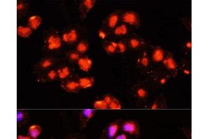 Immunofluorescence analysis of HeLa cells using HOXB9 Polyclonal Antibody at dilution of 1:100 (40x lens). (HOXB9 Antikörper)