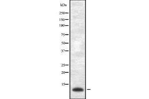 Western blot analysis of VAMP-1/2/3 using Jurkat whole cell lysates (Vamp-1+2+3 Antikörper)