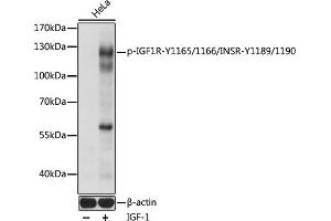Western Blotting (WB) image for anti-Insulin-Like Growth Factor 1 Receptor (IGF1R) (pTyr1165), (pTyr1166), (pTyr1189), (pTyr1190) antibody (ABIN7267900)