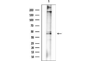 anti-Resistance To Inhibitors of Cholinesterase 3 Homolog (RIC3) antibody