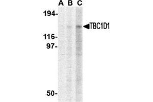 Western blot analysis of TBC1D1 in Daudi cell lysate with this product at (A) 1, (B) 2 and (C) 4 μg/ml. (TBC1D1 Antikörper  (C-Term))