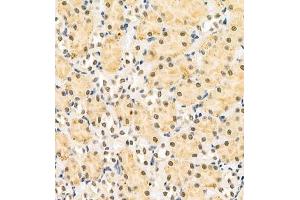 Immunohistochemistry (Paraffin-embedded Sections) (IHC (p)) image for anti-Homeobox C9 (HOXC9) antibody (ABIN7074251)