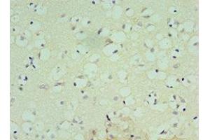Immunohistochemistry of paraffin-embedded human brain tissue using ABIN7148809 at dilution of 1:100 (AFT7 Antikörper  (AA 1-117))