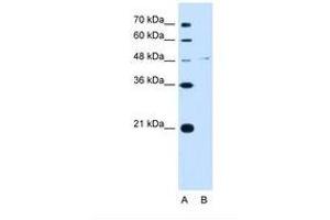 Image no. 1 for anti-Olfactomedin 4 (OLFM4) (C-Term) antibody (ABIN321838)