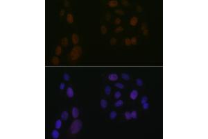 Immunofluorescence analysis of U-2 OS cells using  Rabbit mAb (ABIN3016894, ABIN3016895, ABIN3016896, ABIN1679361 and ABIN1679362) at dilution of 1:100 (40x lens).