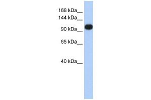 ATP2A3 antibody used at 1 ug/ml to detect target protein. (ATP2A3 Antikörper  (Middle Region))