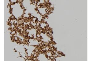 ABIN6259350 and ABIN6275567 at 1/100 staining Mouse lung tissue by IHC-P. (SH3GLB2 Antikörper  (C-Term))