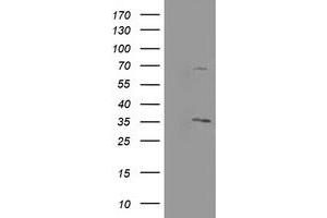 Image no. 2 for anti-Proline Synthetase Co-Transcribed (PROSC) antibody (ABIN1500440) (PROSC Antikörper)