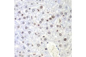 Immunohistochemistry of paraffin-embedded mouse liver using UHRF2 antibody at dilution of 1:200 (400x lens).