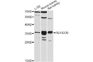 Western blot analysis of extracts of various cell lines, using HLA-DOB antibody (ABIN5997900) at 1:3000 dilution. (HLA-DOB Antikörper)