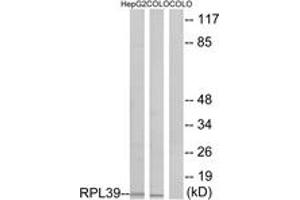 Western blot analysis of extracts from COLO/HepG2 cells, using RPL39 Antibody. (RPL39 Antikörper  (AA 1-50))