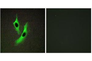 Immunofluorescence analysis of Jurkat cells, using STEAP4 antibody. (STEAP4 Antikörper  (Internal Region))
