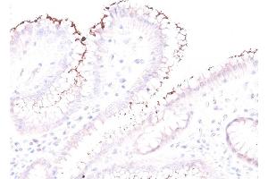 Formalin-fixed, paraffin-embedded human Stomach stained with Helicobacter pylori Rabbit PAb. (Helicobacter Pylori Antikörper)