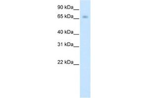 Western Blotting (WB) image for anti-Kelch-like protein 41 (KLHL41) antibody (ABIN2461774) (Kelch-like protein 41 (KLHL41) Antikörper)