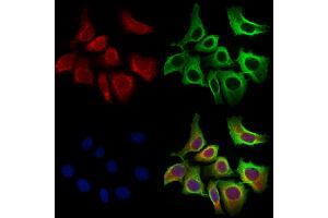 ABIN6259716 and ABIN6273088 staining Hela cells by IF/ICC. (ACADVL Antikörper  (Internal Region))
