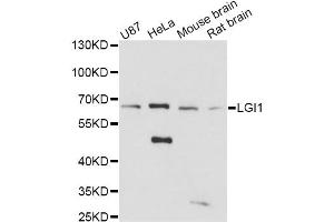 Western blot analysis of extracts of various cell lines, using LGI1 antibody (ABIN1876596) at 1:3000 dilution.