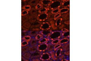 Immunofluorescence (IF) image for anti-ATPase, H+ Transporting, Lysosomal 56/58kDa, V1 Subunit B1 (ATP6V1B1) (AA 1-280) antibody (ABIN6137346)