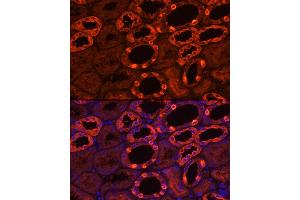 Immunofluorescence analysis of human kidney using V1B1 Rabbit pAb (ABIN6131094, ABIN6137346, ABIN6137347 and ABIN6222603) at dilution of 1:200 (40x lens). (ATP6V1B1 Antikörper  (AA 1-280))