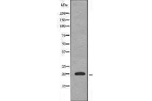 Western blot analysis of extracts from HuvEc cells, using TNFAIP8L2 antibody.