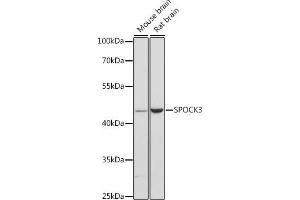 Western blot analysis of extracts of various cell lines, using SPOCK3 antibody (ABIN6131057, ABIN6148367, ABIN6148368 and ABIN6216626) at 1:3000 dilution. (SPOCK3 Antikörper  (AA 180-380))