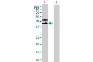 Western Blotting (WB) image for PSG9 293T Cell Transient Overexpression Lysate(Denatured) (ABIN1333151)